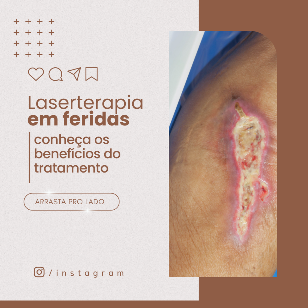 FEED LASETERAPIA (61)