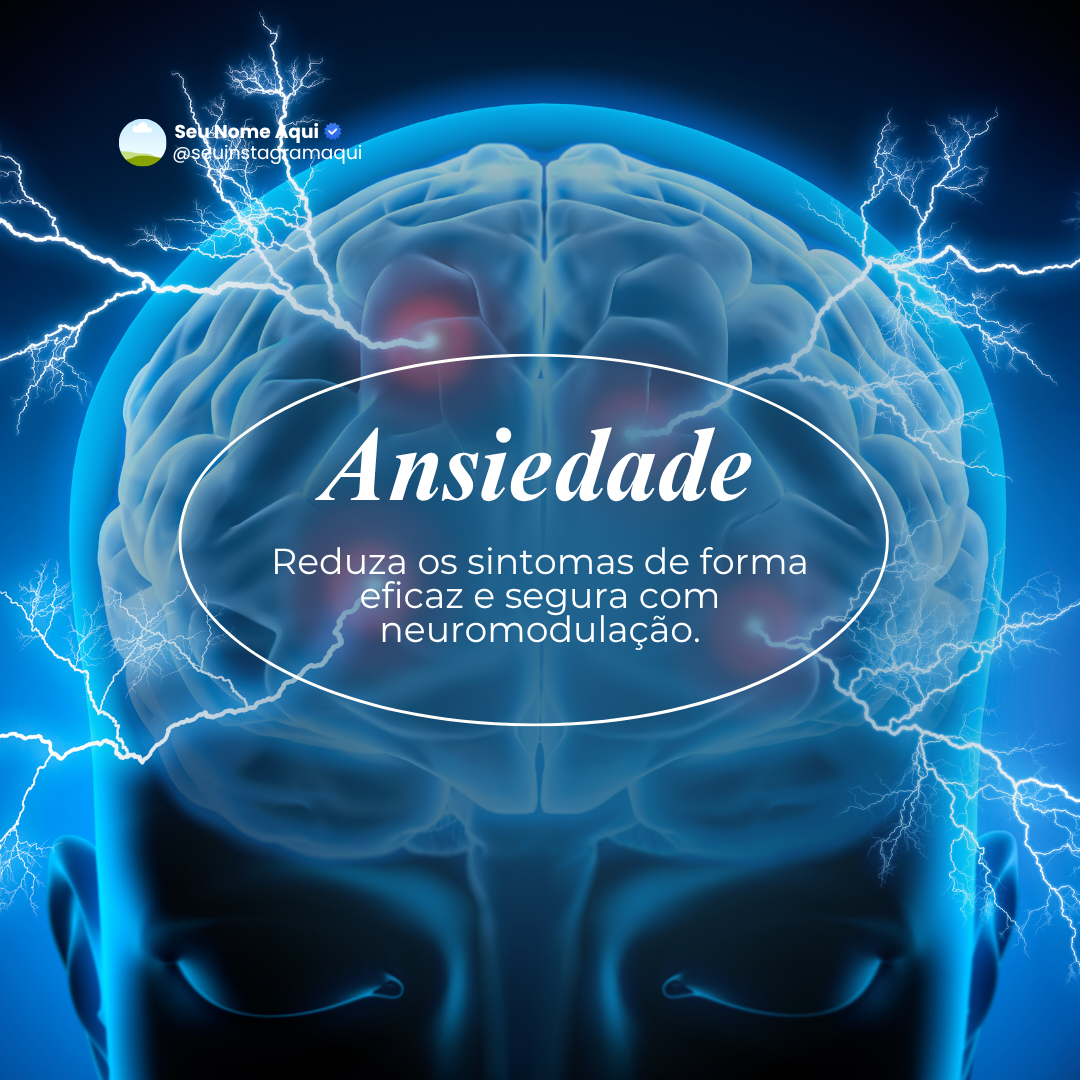 PACK NEUROMODULAÇÃO (56)